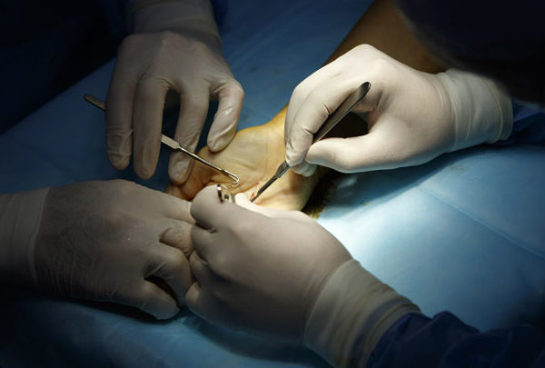 four hands of two surgeons begin the hand surgery with surgical tools
