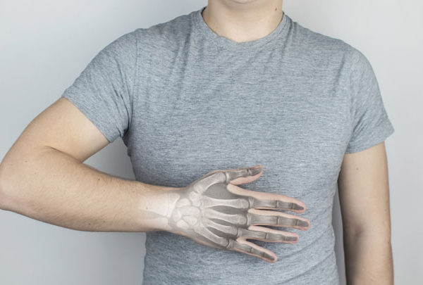 Conceptual photo. X-ray of a man wrist. On the skin of the patient hand, it was as if an image of the fingers and hands appeared. View of bones through the skin. Isolated man on a gray background.