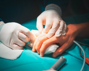 Przykurcz palca po urazie